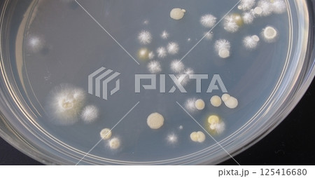 細菌のコロニー 125416680