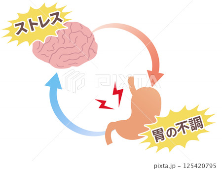 ストレスで胃が痛くなる仕組み、胃脳相関と機能性ディスペプシアの概念図。 ストレスで胃が痛くなる仕組み、胃脳相関と機能性ディスペプシアの概念図。 125420795
