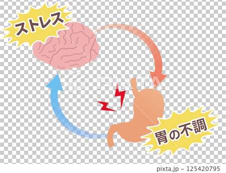 ストレスで胃が痛くなる仕組み、胃脳相関と機能性ディスペプシアの概念図。 ストレスで胃が痛くなる仕組み、胃脳相関と機能性ディスペプシアの概念図。 125420795