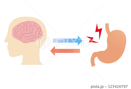ストレスで胃が痛くなる仕組み、胃脳相関と機能性ディスペプシアの概念図。 125420797