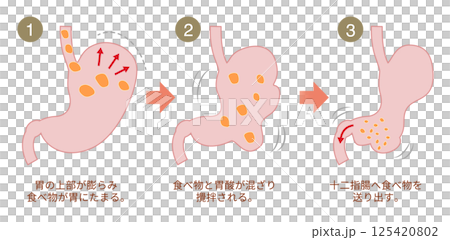 胃が食べ物を消化する仕組みの説明図 125420802
