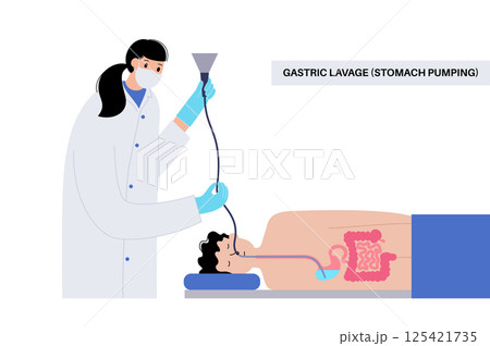 Stomach wash gastric lavage Stomach wash gastric lavage 125421735
