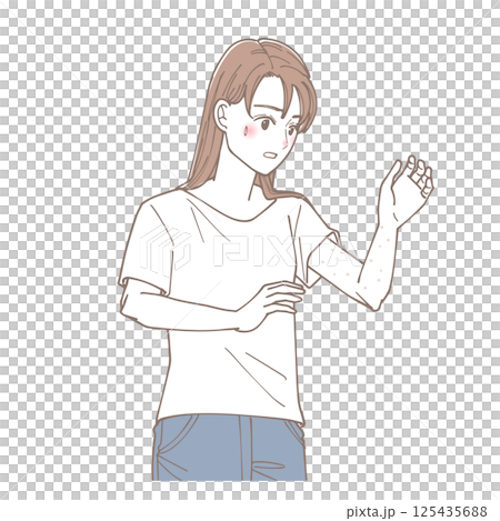 Illustration of a woman with eczema on her arm 125435688