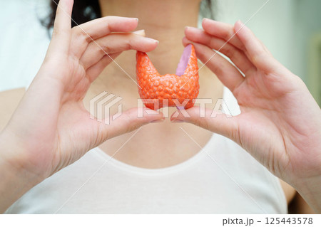 Hyperthyroidism, Overactive Thyroid, Thyroid Lymphoma, Asian woman with thyroid gland human anatomy model. 125443578
