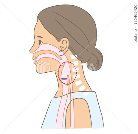 正常な姿勢の女性、頸椎と咽頭のイラスト 正常な姿勢の女性、頸椎と咽頭のイラスト 125466426