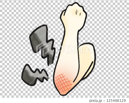 Elbow pain that feels like an electric current running through it (black) 125486129