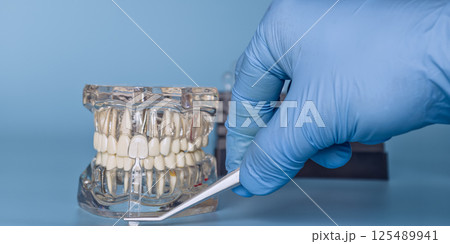 Model of teeth with sample size and hand in glove Model of teeth with sample size and hand in glove 125489941