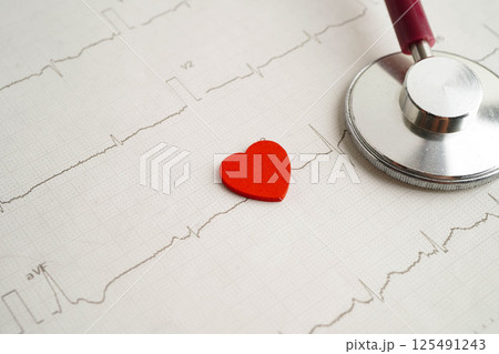 Stethoscope on electrocardiogram ECG, heart wave, heart attack, cardiogram report. 125491243