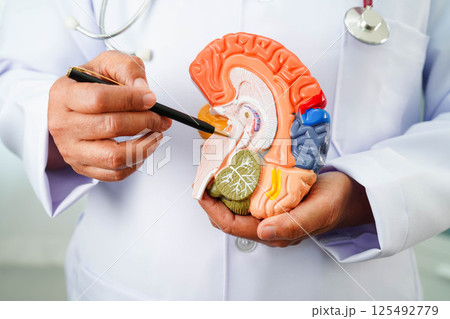 Alzheimer disease, Asian doctor holding brain anatomy model for study diagnosis and treatment in hospital. Alzheimer disease, Asian doctor holding brain anatomy model for study diagnosis and treatment in hospital. 125492779