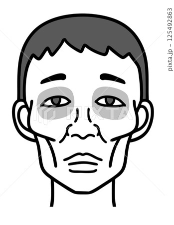 ヒポクラテス顔貌、痩せた男性の顔、白黒 125492863