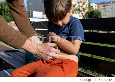 Diabetes management: parent assisting child with insulin injection outdoors 125499842