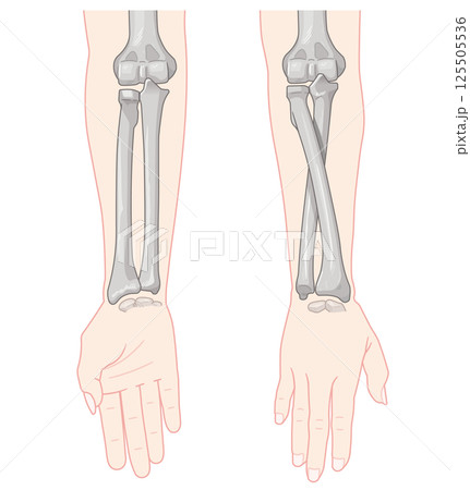 前腕の回内運動・回外運動のイラスト Arm Pronation and Supination 125505536