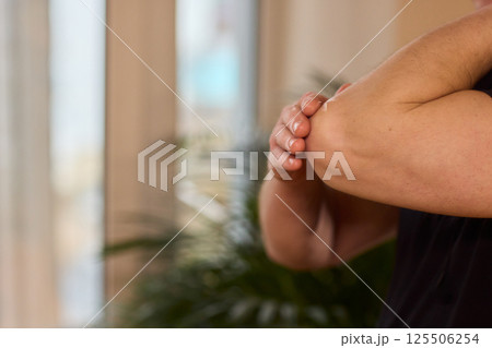 A closeup image showcasing a hand actively examining a particular skin condition on an elbow region 125506254