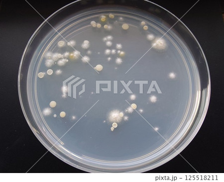 っシャーレに生育したコロニーの様子 125518211