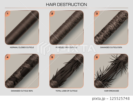 Hair damage and breakage showing the progressive stages of hair cuticle damage from healthy, closed cuticle to extreme breakage. Vector infographic for use in haircare education, salon promotions 125525748