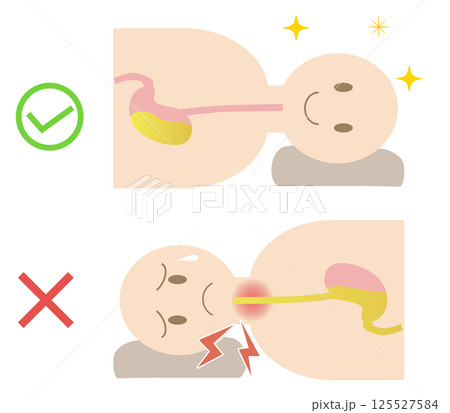 胃酸の逆流を防ぐ正しい寝方の姿勢 胃酸の逆流を防ぐ正しい寝方の姿勢 125527584