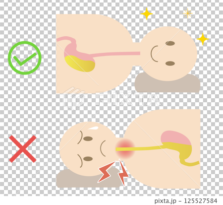 胃酸の逆流を防ぐ正しい寝方の姿勢 胃酸の逆流を防ぐ正しい寝方の姿勢 125527584