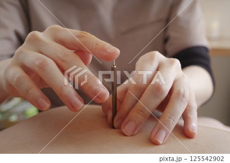 鍼灸院で背中に鍼治療をする女性 鍼灸院で背中に鍼治療をする女性 125542902
