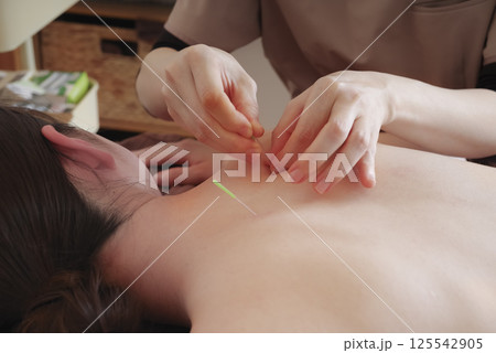 鍼灸院で背中に鍼治療をする女性 鍼灸院で背中に鍼治療をする女性 125542905