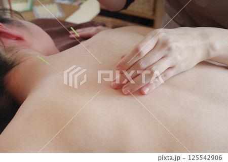 鍼灸院で背中に鍼治療をする女性 鍼灸院で背中に鍼治療をする女性 125542906