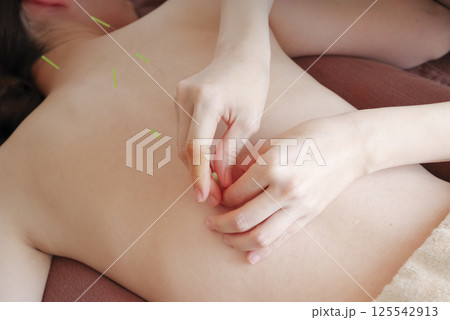 鍼灸院で背中に鍼治療をする女性 鍼灸院で背中に鍼治療をする女性 125542913