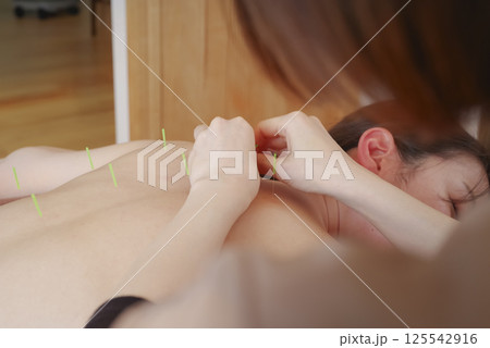 鍼灸院で背中に鍼治療をする女性 125542916