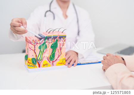 woman Patient consultation Dermatologist with anatomy of skin and hair. Skin disease and Hair loss, Systemic Lupus Erythematosus or SLE, world lupus day, May Melanoma and Skin Cancer Awareness month 125571803