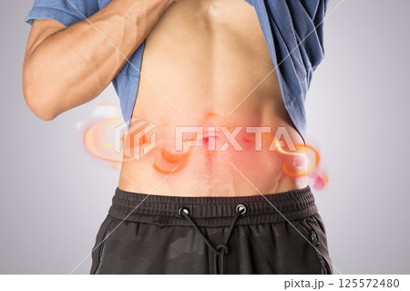 Man experiences shingles rash along waistline. Man experiences shingles rash along waistline. 125572480