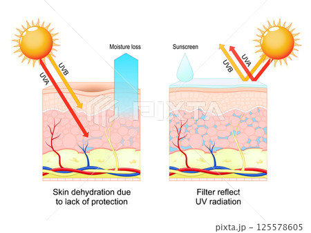 Skin protection. Sunscreen, UV radiation and SPF 125578605