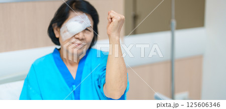 Elderly Woman with eye protective shield after eye surgery. Eye disease, Cataract,  Glaucoma, Age Related Macular Degeneration, Diabetic Retinopathy, Vitreous, Lasik, World Glaucoma day and health 125606346