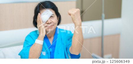 Elderly Woman with eye protective shield after eye surgery. Eye disease, Cataract,  Glaucoma, Age Related Macular Degeneration, Diabetic Retinopathy, Vitreous, Lasik, World Glaucoma day and health 125606349