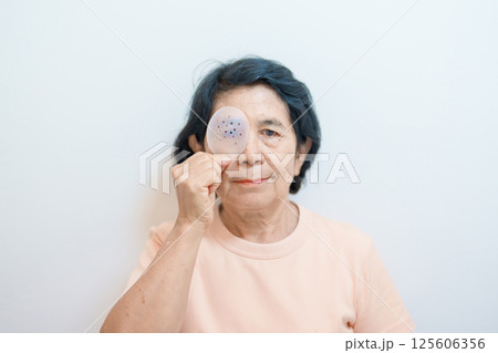 Elderly Woman with eye protective shield after eye surgery. Eye disease, Cataract,  Glaucoma, Age Related Macular Degeneration, Diabetic Retinopathy, Vitreous, Lasik, World Glaucoma day and health 125606356