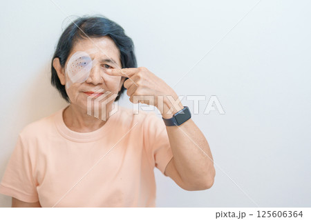 Elderly Woman with eye protective shield after eye surgery. Eye disease, Cataract, Glaucoma, Age Related Macular Degeneration, Diabetic Retinopathy, Vitreous, Lasik, World Glaucoma day and health Elderly Woman with eye protective shield after eye surgery. Eye disease, Cataract, Glaucoma, Age Related Macular Degeneration, Diabetic Retinopathy, Vitreous, Lasik, World Glaucoma day and health 125606364