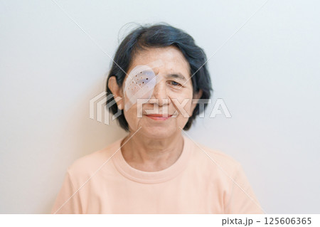 Elderly Woman with eye protective shield after eye surgery. Eye disease, Cataract, Glaucoma, Age Related Macular Degeneration, Diabetic Retinopathy, Vitreous, Lasik, World Glaucoma day and health Elderly Woman with eye protective shield after eye surgery. Eye disease, Cataract, Glaucoma, Age Related Macular Degeneration, Diabetic Retinopathy, Vitreous, Lasik, World Glaucoma day and health 125606365