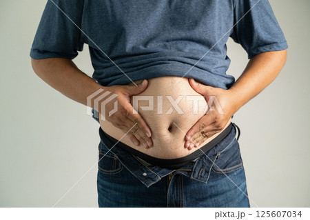 Overeating causes belly fat, tight jeans, and cellulite a healthy lifestyle and diet improve body shape and wellness man wants to lose weight 125607034