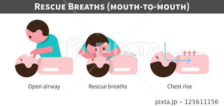 CPR . Cardiopulmonary resuscitation . Procedure of rescue breaths and mouth ot mouth . Flat design cartoon characters . Isolate white background . Vector . 125611156