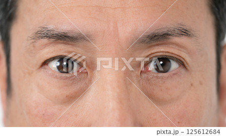 男性　目元　アイフレイル 125612684