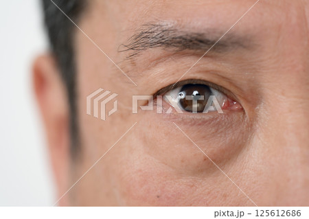 男性　目元　アイフレイル 125612686