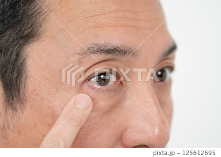 男性　目元　アイフレイル 125612695