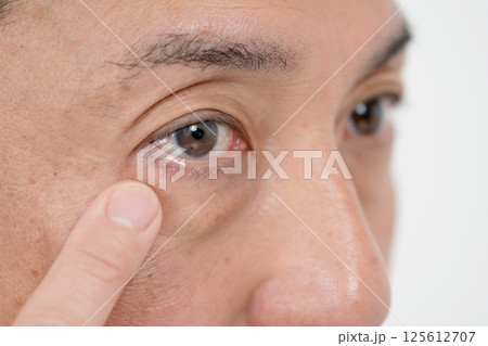 男性　目元　アイフレイル 125612707