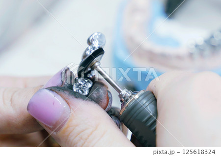 Crafting precision metal dentures with skilled hands in a modern dental lab Crafting precision metal dentures with skilled hands in a modern dental lab 125618324
