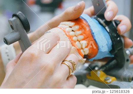 Crafting custom dentures with precision for perfect dental fit 125618326