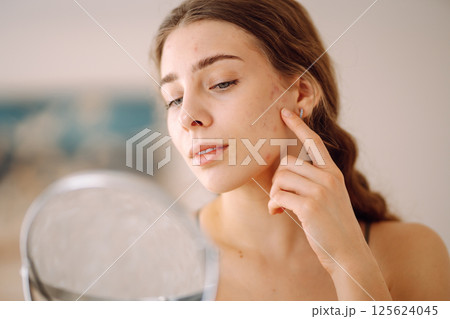 Woman worry about her face when she saw the problem of acne occur by a mini mirror. Pimples, acne Woman worry about her face when she saw the problem of acne occur by a mini mirror. Pimples, acne 125624045
