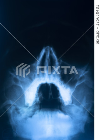 Xray scan skull nose 125650481