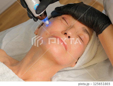Close-up portrait of a beautiful aged woman during microneedling with dermapen from a beautician. Close-up portrait of a beautiful aged woman during microneedling with dermapen from a beautician. 125651803