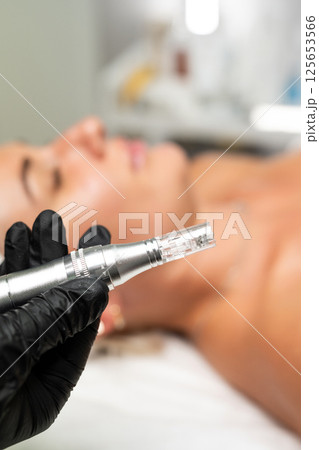 Microneedle RF lifting procedure. A cosmetologist performs a facial rejuvenation procedure on a woman. Hardware cosmetology. 125653566