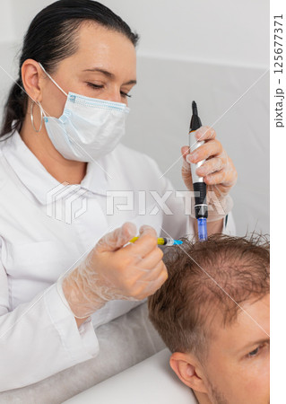 Trichologist doing man improve hair growth procedure, dermapen microneedling, vitamin injections 125677371