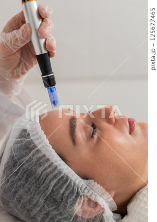 Cosmetologist performs dermapen microneedling on forehead skin of young woman in beauty clinic 125677465