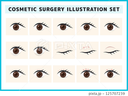 美容整形・目の症状・病気のイラスト素材セット 125707239