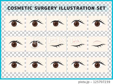 美容整形・目の症状・病気のイラスト素材セット 125707239